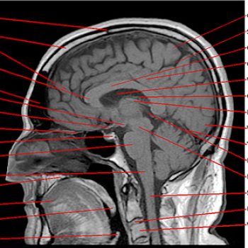 optimización cerebro